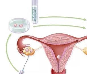 南昌做试管婴儿的成功率，南昌做试管婴儿的具体流程